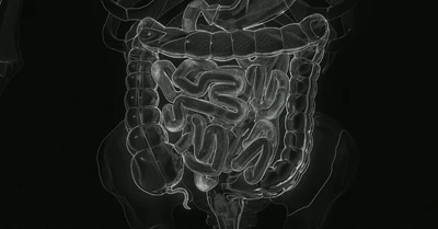 Wahls-Healing Leaky Gut Naturally-Sept26